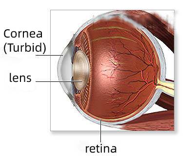 Figure 2 （The eye section 2）