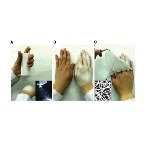 Electrospun nanofibers as a wound dressing for treating diabetic foot ulcer