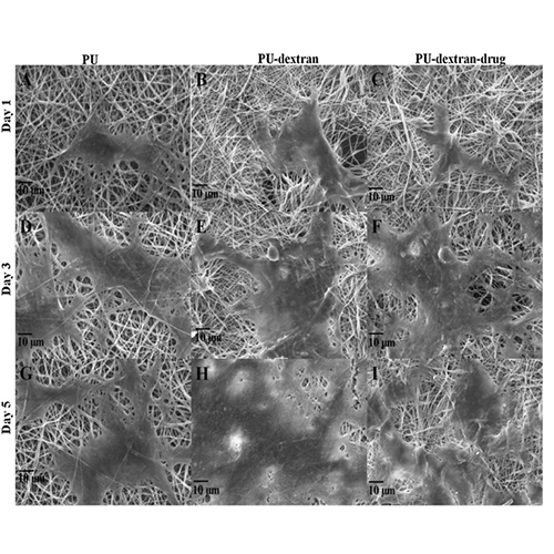 Wound-dressing materials with antibacterial activity from electrospun polyurethane–dextran nanofiber mats containing ciprofloxacin HCl